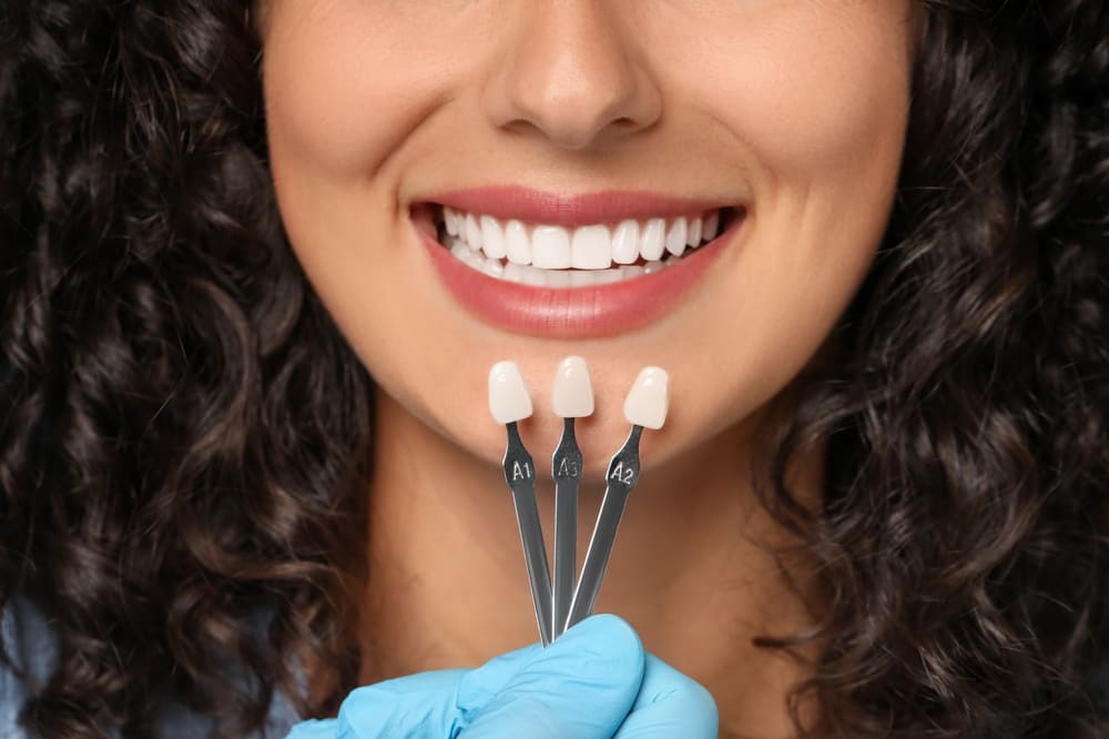 cosmesi dentale Lodi