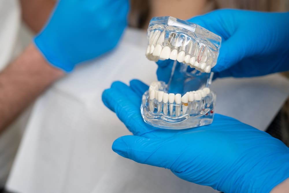 implantologia computer assistita Lodi