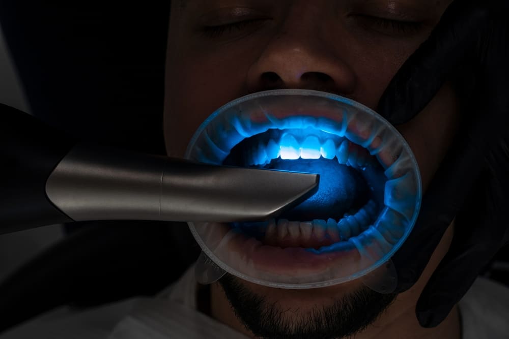 impronte dentali digitali Lodi